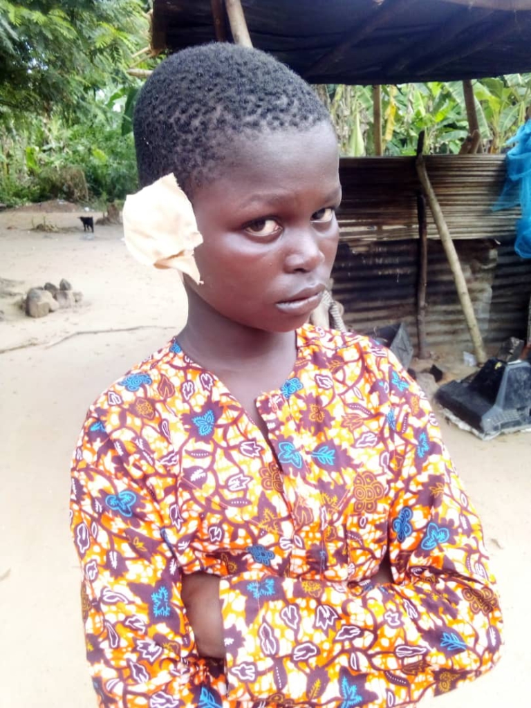 Man cuts off son's ear, burns his fingers for stealing ¢250