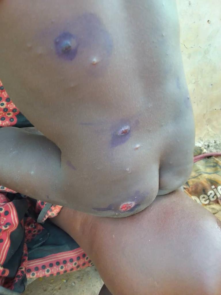 Sekyere East District Health Directorate appeals for public support in battle against NTDs 6 WhatsApp Image 2023 12 26 at 10.27.21