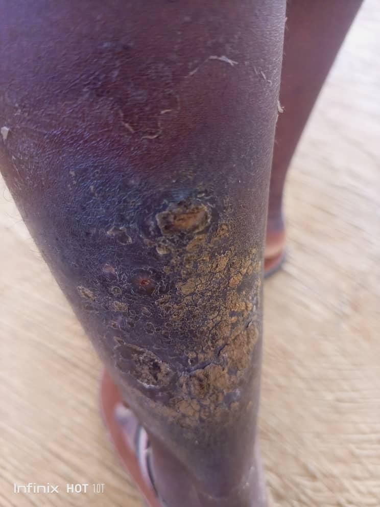 Sekyere East District Health Directorate appeals for public support in battle against NTDs 5 WhatsApp Image 2023 12 26 at 10.27.22