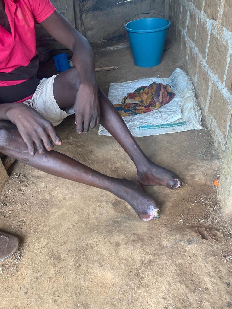 Sekyere East District Health Directorate appeals for public support in battle against NTDs 4 WhatsApp Image 2023 12 26 at 10.29.52