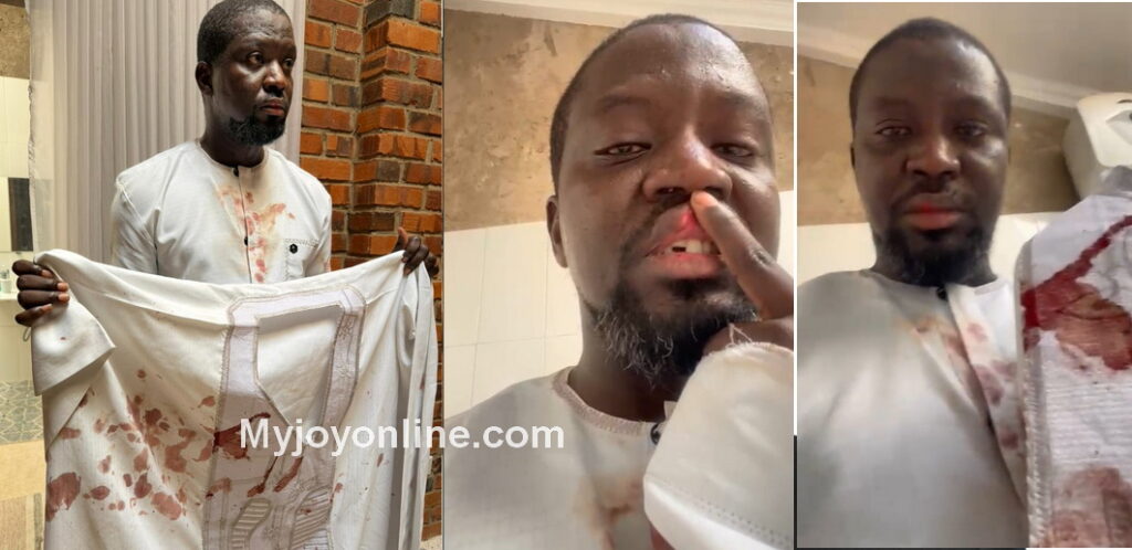 Police launch investigation into alleged assault on artist Ibrahim Mahama Ibrahim Mahama showing his blood-soaked dress, the cut on his lip and broken tooth