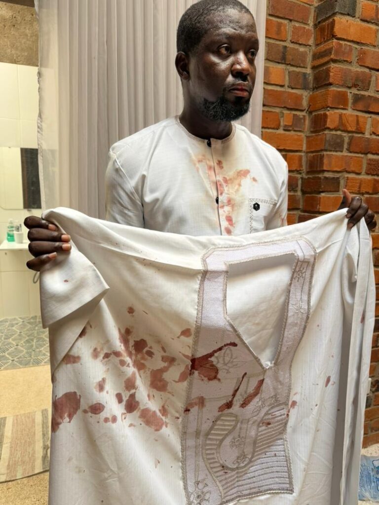 Police launch investigation into alleged assault on artist Ibrahim Mahama Police launch investigation into alleged assault on artist Ibrahim Mahama