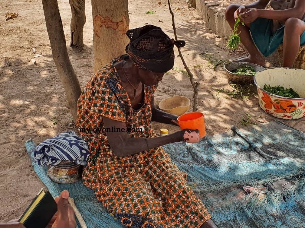 Story of the 80-year-old leper abandoned by her children