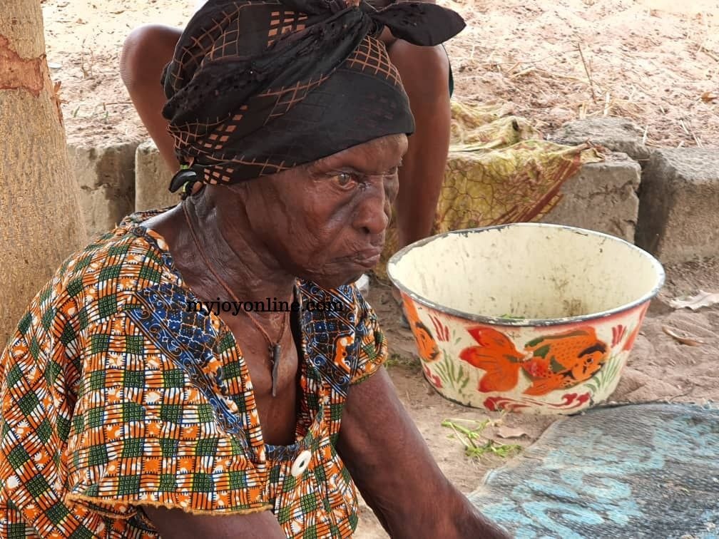 Story of the 80-year-old leper abandoned by her children