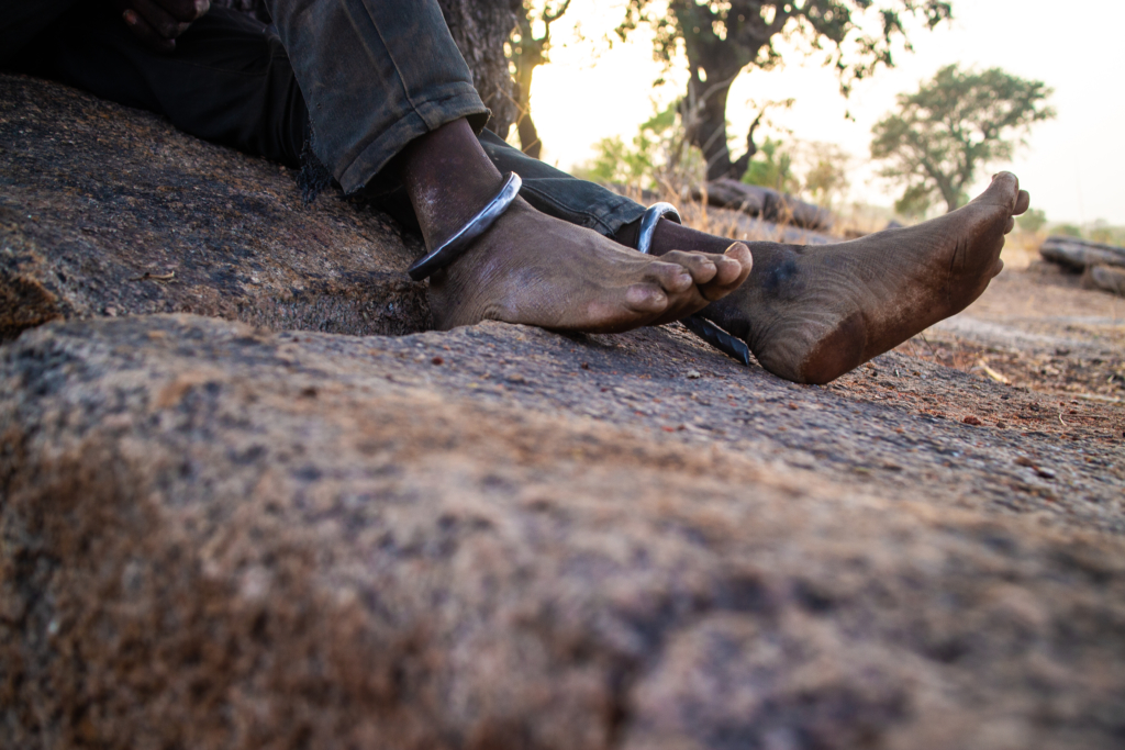 Shackled by logs: Ordeal of Ghana’s mentally ill