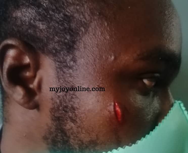 Investigate and prosecute attackers of Daily Graphic reporter at Bright SHS - GJA