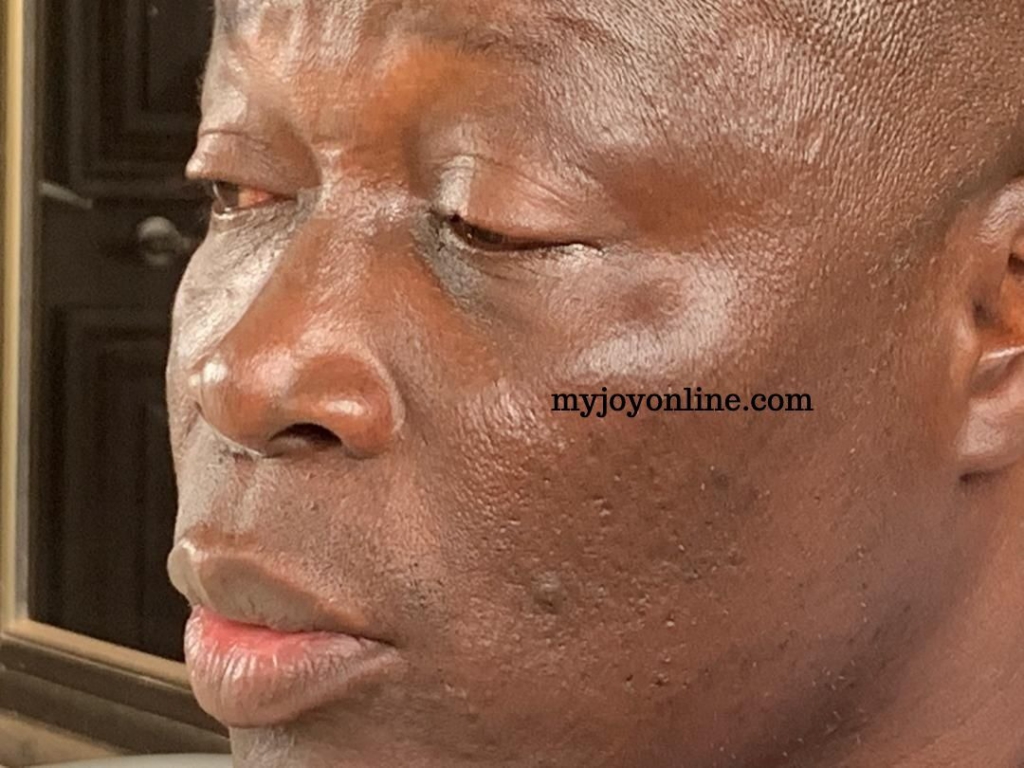 Nii Lante Vanderpuye was assaulted by boys who defected from NDC - NPP Parliamentary candidate for Odododiodoo