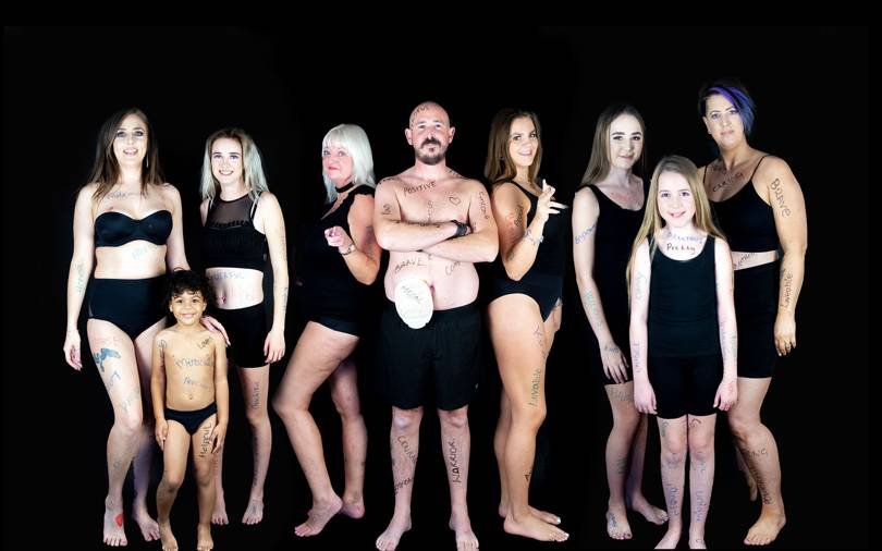 'People are abused every day because their fight isn't visible': This inspiring campaign is raising awareness of invisible illnesses