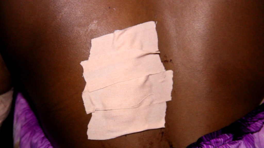 22-year-old lady survives multiple stab wounds from boyfriend at Tafo Zongo