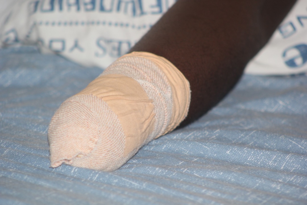 Electrician whose wrist was cut off by 3 men in Aboabo seeks justice Electrician whose wrist was cut off by 3 men in Aboabo seeks justice