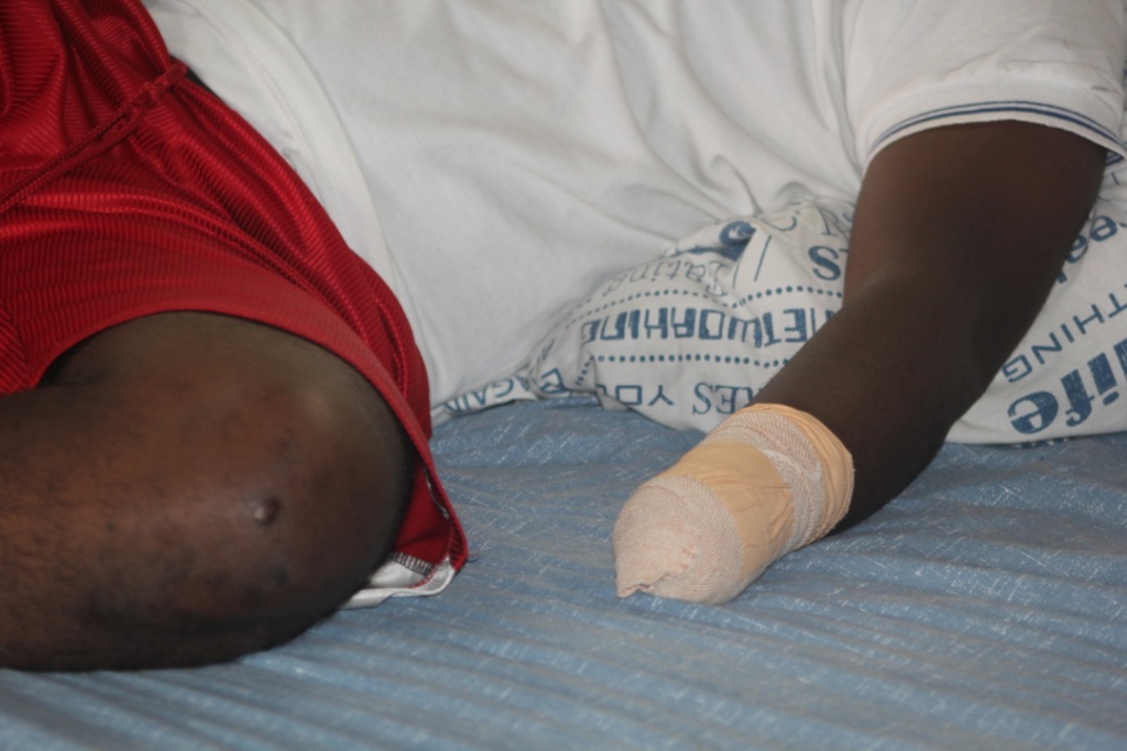 Electrician whose wrist was cut off by 3 men in Aboabo seeks justice