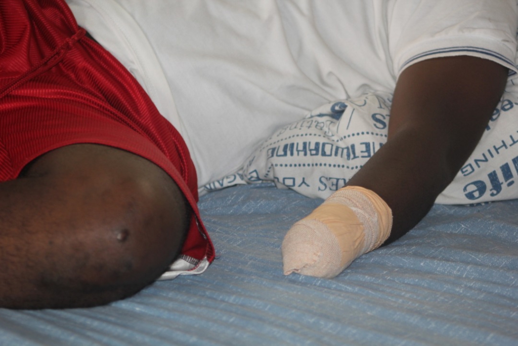 Electrician whose wrist was cut off by 3 men in Aboabo seeks justice Electrician whose wrist was cut off by 3 men in Aboabo seeks justice