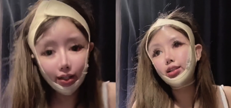 16-year-old girl allegedly undergoes 100 cosmetic procedures in 3 years