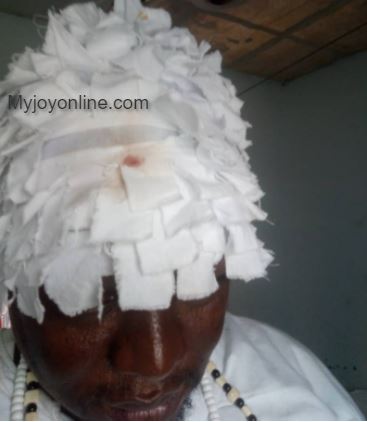 Teshie Wulomo, 2 others injured after gunmen fire shots during pre-Homowo rituals