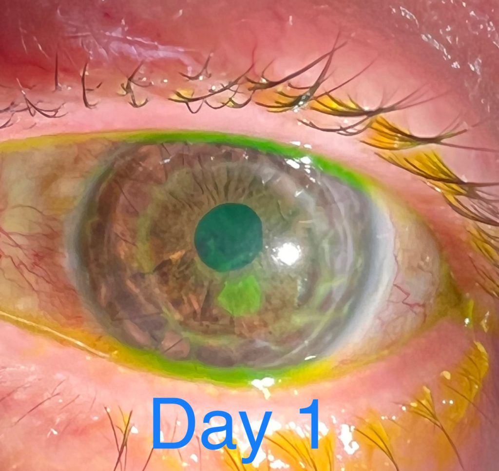Doctor uses iPhone 13 Pro’s Macro camera to check patients’ eyes