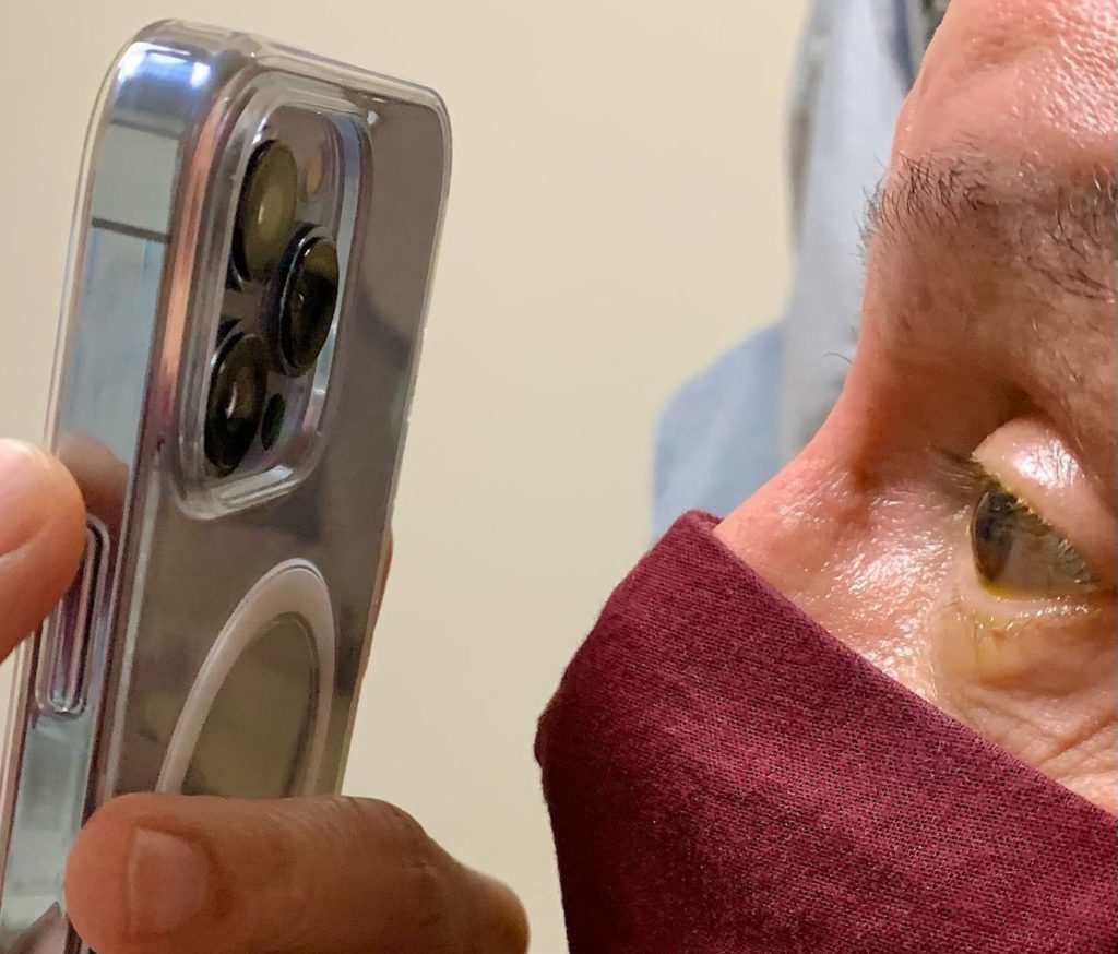 Doctor uses iPhone 13 Pro’s Macro camera to check patients’ eyes