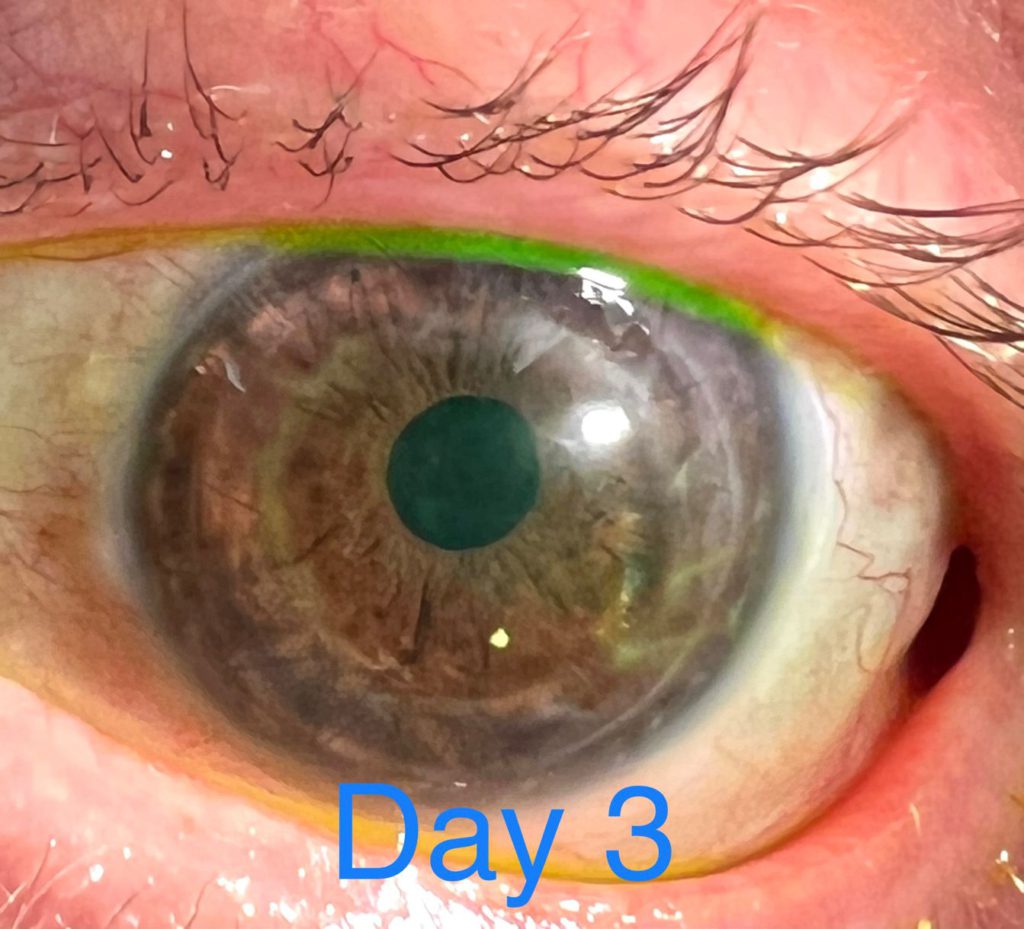Doctor uses iPhone 13 Pro’s Macro camera to check patients’ eyes
