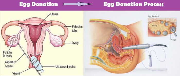 Inside Nigeria’s unregulated human egg industry