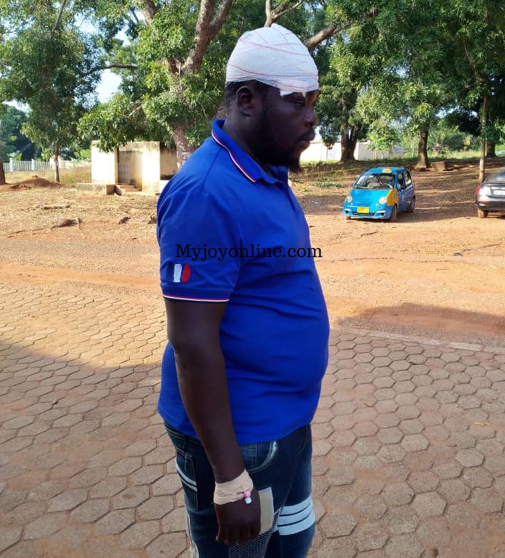 Some Yilo Krobo residents accuse NPP constituency executive of thug brutalities in the area
