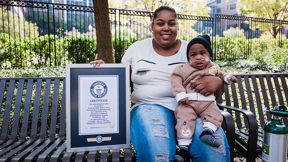 Alabama boy certified as world's most premature baby