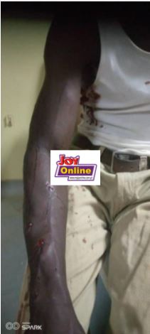 45-year-old lynched for shooting 5 persons in Tamale