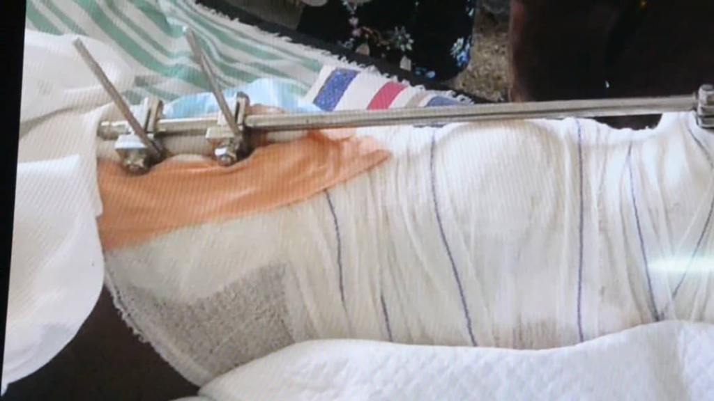 Government will reimburse all medical costs of Apeatse victims - W/R GHS Director