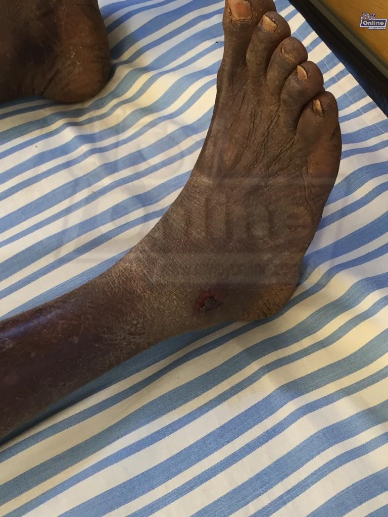 70-year-old man beaten to pulp in Damongo for being a wizard 70-year-old man beaten to pulp in Damongo for being a wizard
