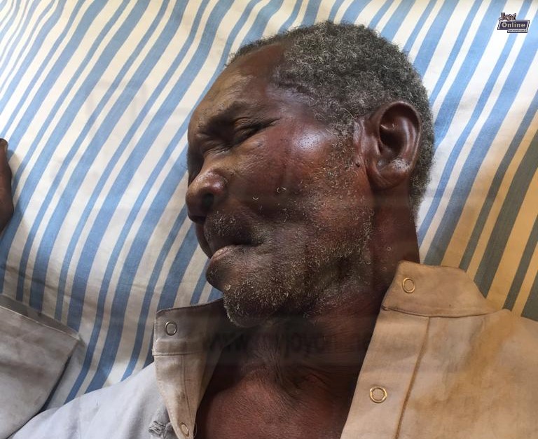 70-year-old man beaten to pulp in Damongo for being a wizard 70-year-old man beaten to pulp in Damongo for being a wizard