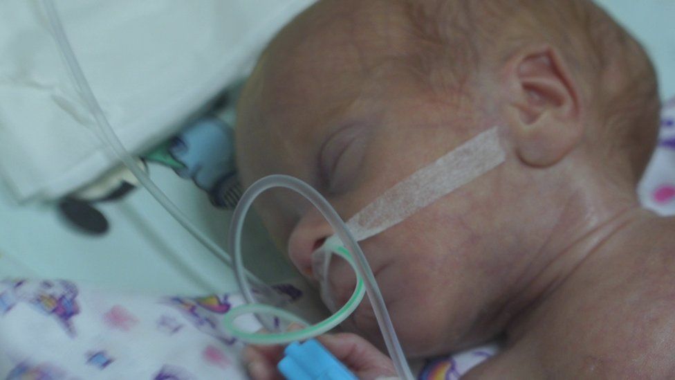 Ukraine invasion: Premature babies struggling for life in bombed cities