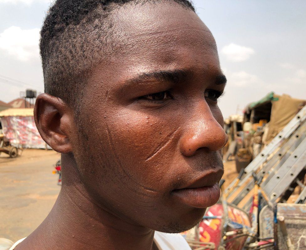 Nigeria's facial scars: The last generation
