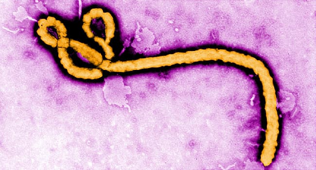‘There is no Ebola in Ghana’ – GHS