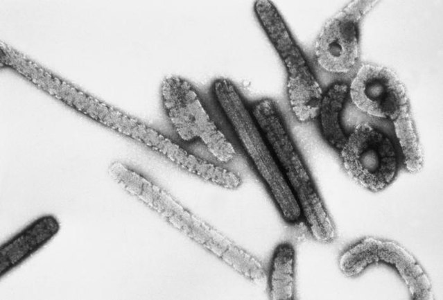 Marburg virus: 1 more person dies; 40 quarantined in Ghana