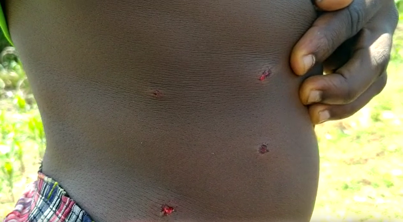 5 people sustain bullet wounds during Bibiani protest