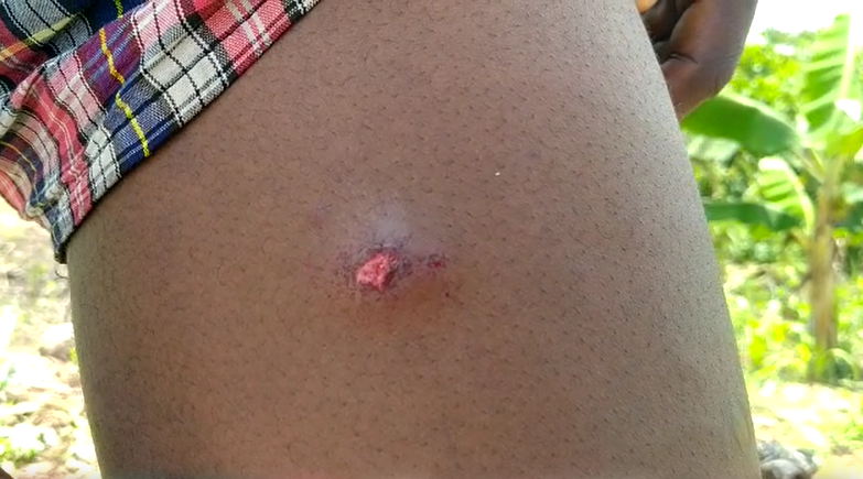 5 people sustain bullet wounds during Bibiani protest