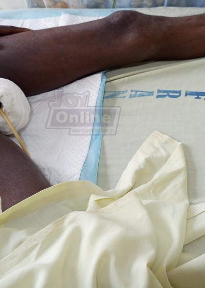 Farmer chops off his scrotum while asleep Farmer chops off his scrotum while asleep