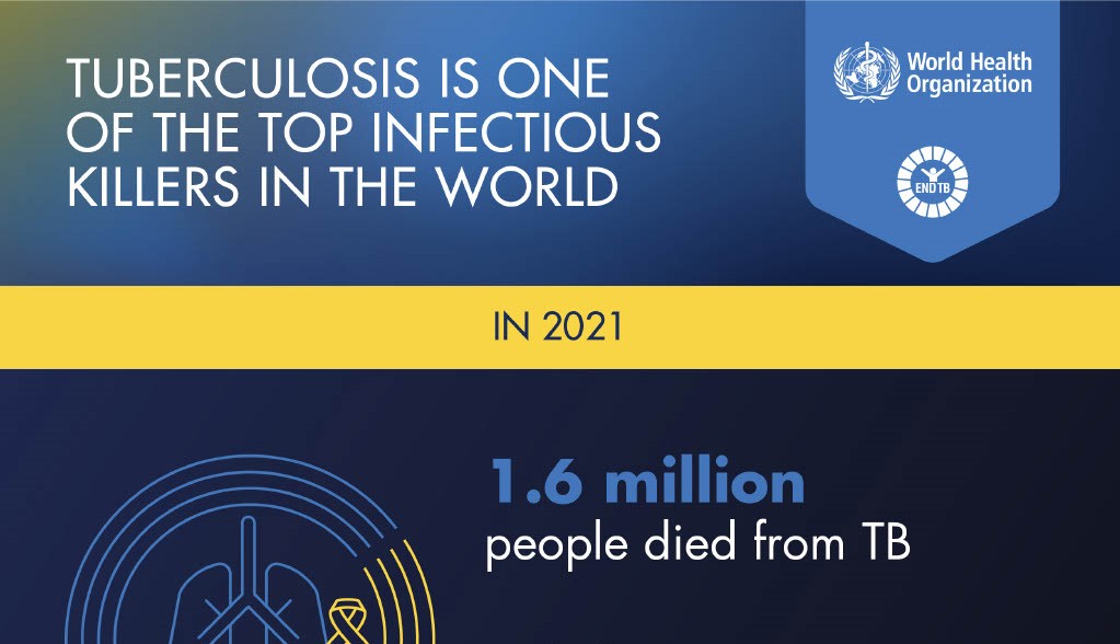 Shorter treatment regimen found for Multidrug-Resistant Tuberculosis