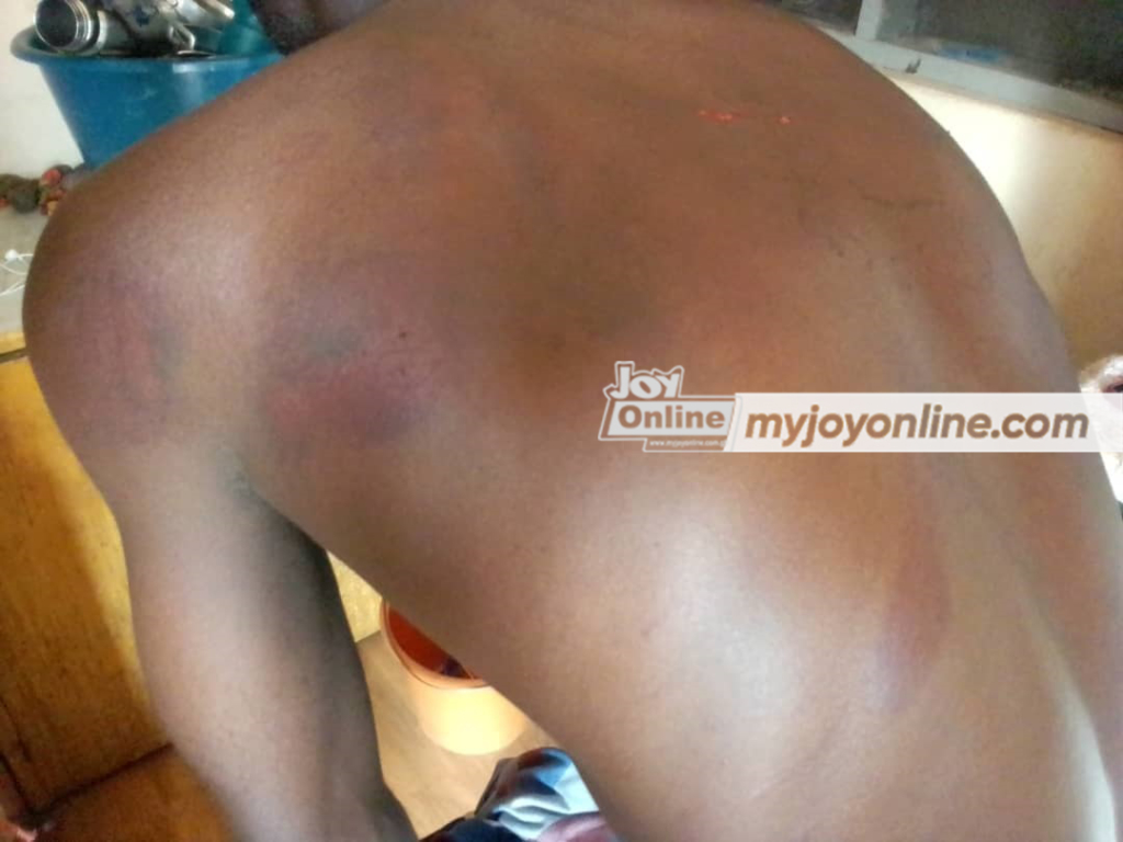 Ashaiman: Soldiers put a gun to my head and threatened to kill me - Victim narrates