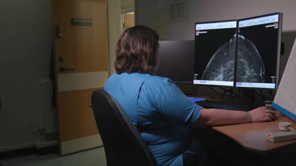 How AI is helping doctors spot breast cancers