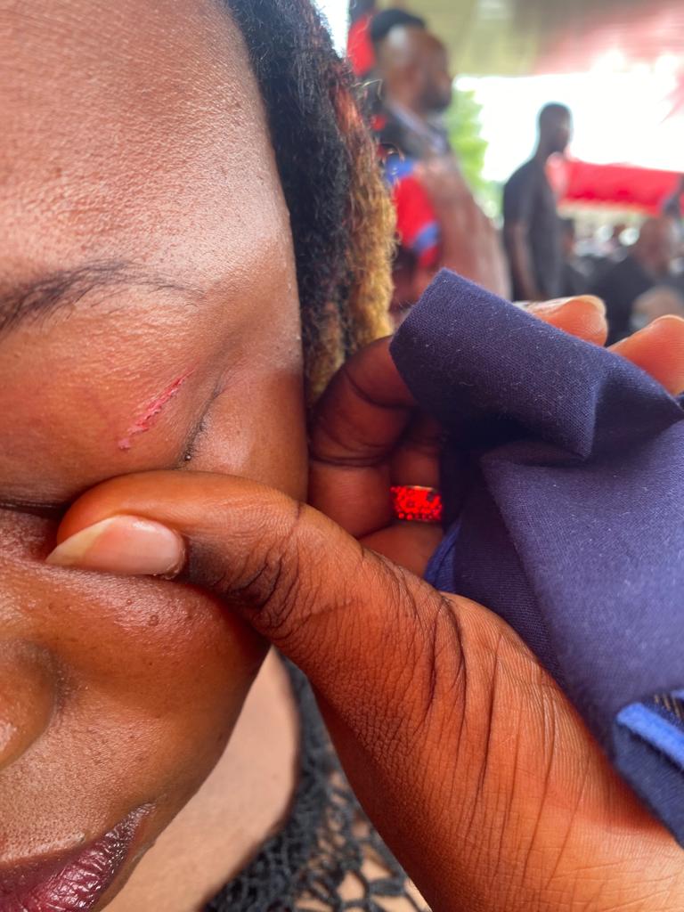 Agotime Ziope DCE attacks NPP's Dzifa Kaledzi; leaves her with an eye injury