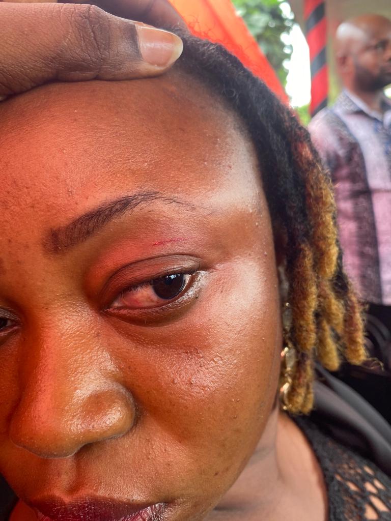Agotime Ziope DCE attacks NPP's Dzifa Kaledzi; leaves her with an eye injury Agotime Ziope DCE attacks NPP's Dzifa Kaledzi; leaves her with an eye injury