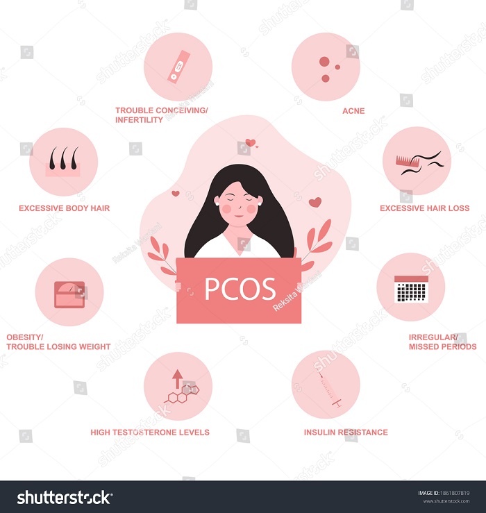PCOS Infertility Dos and Don’ts, and all you need to know about