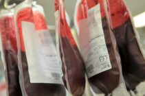 Each Jehovah’s Witness member now decides whether to accept or donate main blood components