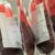 Each Jehovah’s Witness member now decides whether to accept or donate main blood components