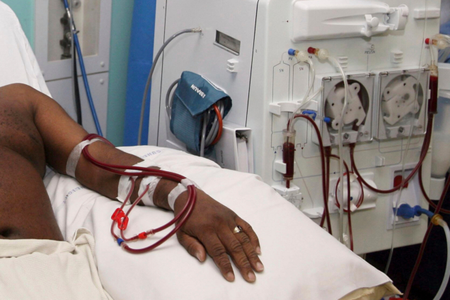 Korle-Bu apologises for disquiet caused by proposed hike in cost of dialysis services