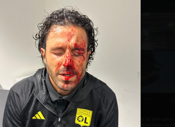 Fabio Grosso: Lyon manager ‘seriously injured’ as team bus attacked in Marseille 2 Screenshot 2023 10 30 081350
