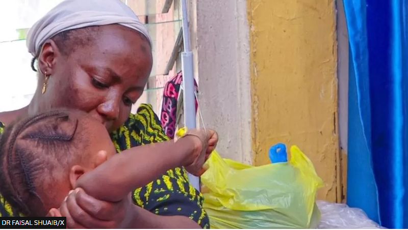 Nigeria diphtheria outbreak kills 600 2 diphtheria
