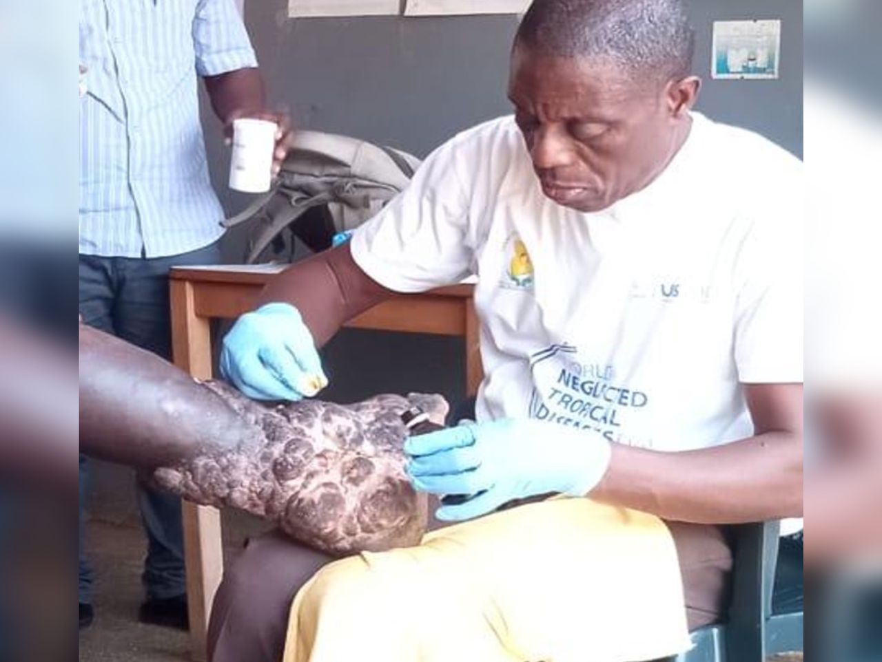HFFG leads community empowerment in Ghana to eliminate Neglected Tropical Diseases - Vimarsana News