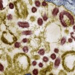 GHS issues alert as Marburg virus outbreak is confirmed in Ethiopia