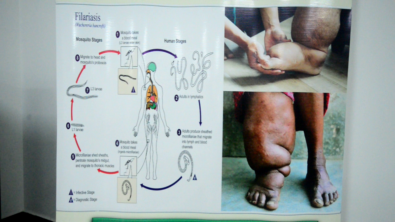 “Stop the pity narratives”: African media urged to reframe stories on neglected tropical diseases