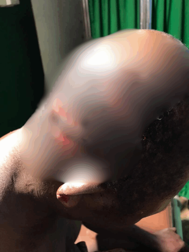 Okada rider survives brutal machete attack in Boinso, suspect arrested – MyJoyOnline